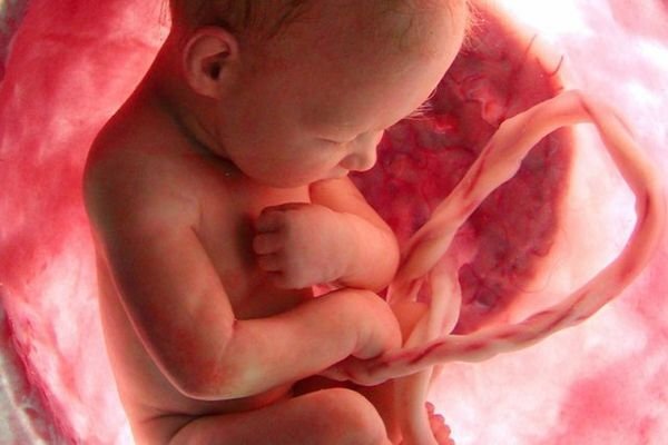 Факторы риска и причины внутриутробного инфицирования плода с развитием воспаления легких: