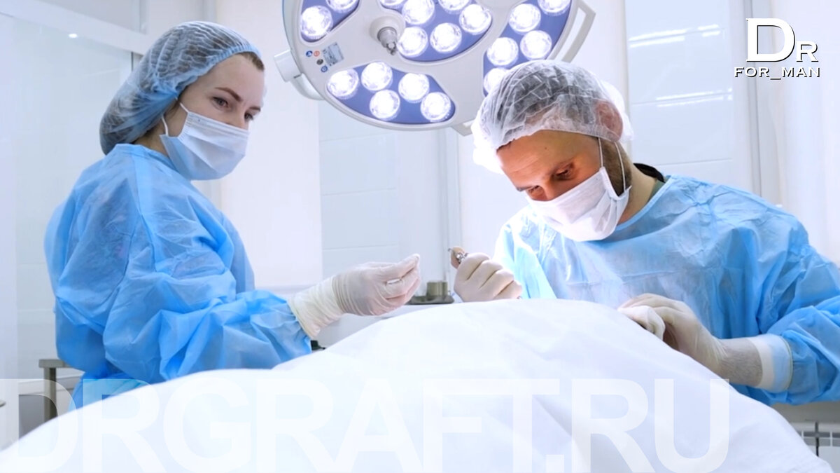 Пересадка волос в Москве