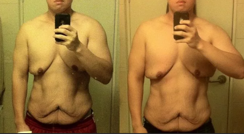 Pin on Weight Loss Journey