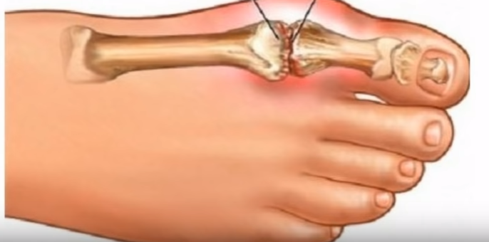 Мочевая кислота