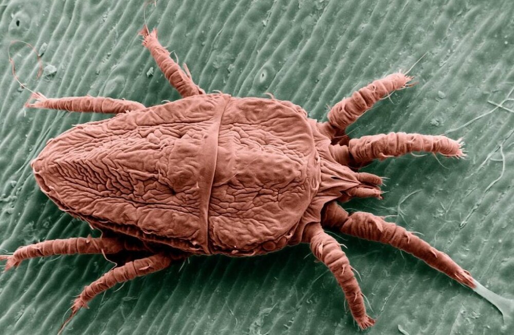 Чесоточный зудень