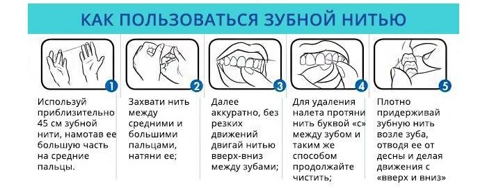 Правильное использование зубной нити для чистки межзубных промежутков