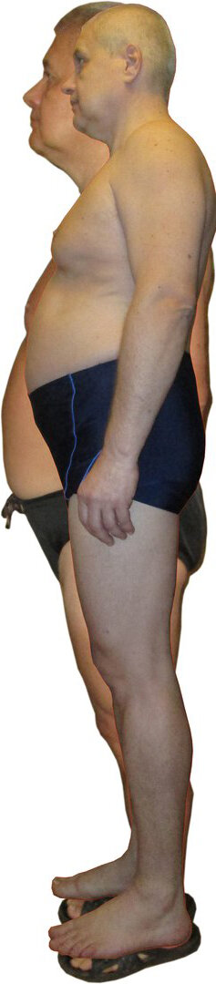 Как в 57 лет следить за своим весом и поддерживать его. 31.07.18 – 77кг ,310818 – 76 кг , 30098 – 77 кг, 311018 – 78 кг,301118 – 76,191218 – 78кг,
310119 – 81кг,280219 – 81кг,3110319 – 80,300419 -81,310519 – 81,300619 – 81,310719 – 83
310819 – 82,300919 – 82,311019 -86,291119 -88,301219 – 89,310120 – 89,150220 – 88
С 2017 года снизил вес с 96 кг. до 76 кг – на 30 кг. Затем перестал следить за собой
На весах . В итоге начал опять худеть и взвешиваться.
Я понял , что все физические нагрузки снижают вес наименее эффективно, чем
Изменение питания.
Мой рацион питания :
1. Яйца.
2. Творог с грецкими орехами.
3. Салат с огурцами капустой яблоками и зеленью.
4. Эти три позиции у меня разбиты на 5 приемов. Раньше 2 приема у меня был протеин.
5. Временно из рациона исключено мясо, хотя при желании можно его добавить.
6. Вода принимается за полчаса и через полчаса после еды от 100 до 200 грамм.
7. Итого максимум воды за день 2 литра воды.
8. Если вдруг вылезают проблемы с почками надо добавить в рацион огурцы.
9. Из физических упражнений обязательно вакум, ходьба, бассейн.
10. Всякие серьезные физические упражнения могут начать увеличивать Ваш вес.
Итак начнем : вчера 13.02.2020 – 90,90 кг, 14.02.2020 – 88,40 кг, 15.02.2020 -88.15 кг.
