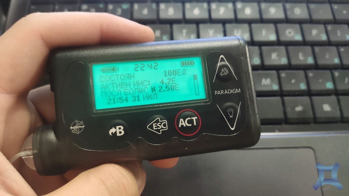 Удобно смотреть по времени когда была сделана инъекция, и сколько времени прошло. А также, сколько активного инсулина в данную минуту.