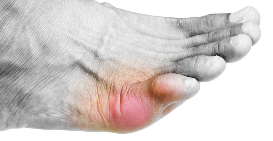 Источник фото: https://nogostop.ru/stopa/palcy/ushib-mizinca-na-noge.html                            