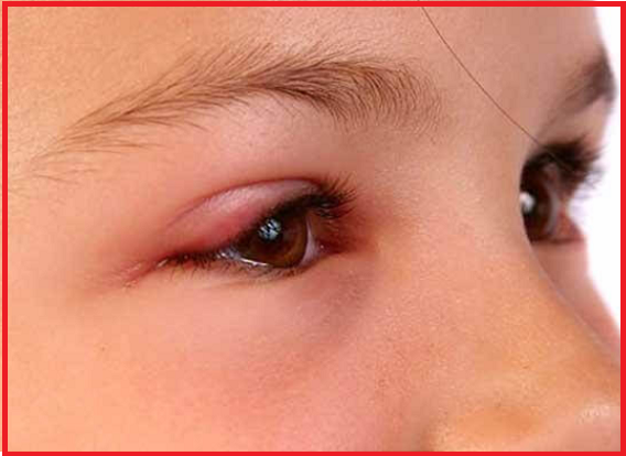 foto: http://med88.ru