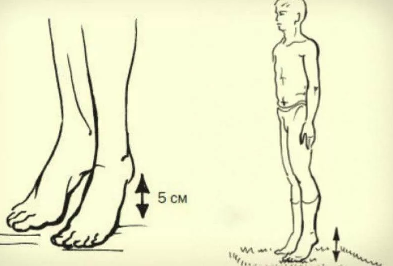 упражнения для разгона лимфы. прыжки от отеков утром. пятками об пол. толчки пятками. виброгимнастика микулина техника.