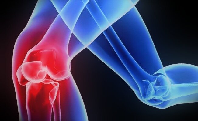Коленный сустав.