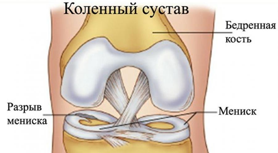  Почти у всех болело колено. Все мы падали, особенно в детстве, в кровь текли, а иногда даже хромали.-2