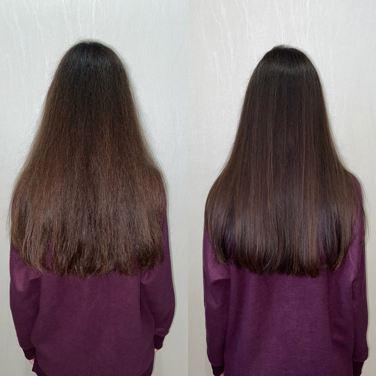 До и после использования филлера Lador