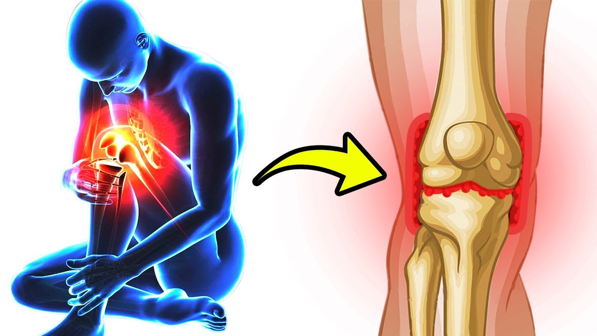 Причина сильной боли в суставах. Боль в суставах. Здоровые суставы.