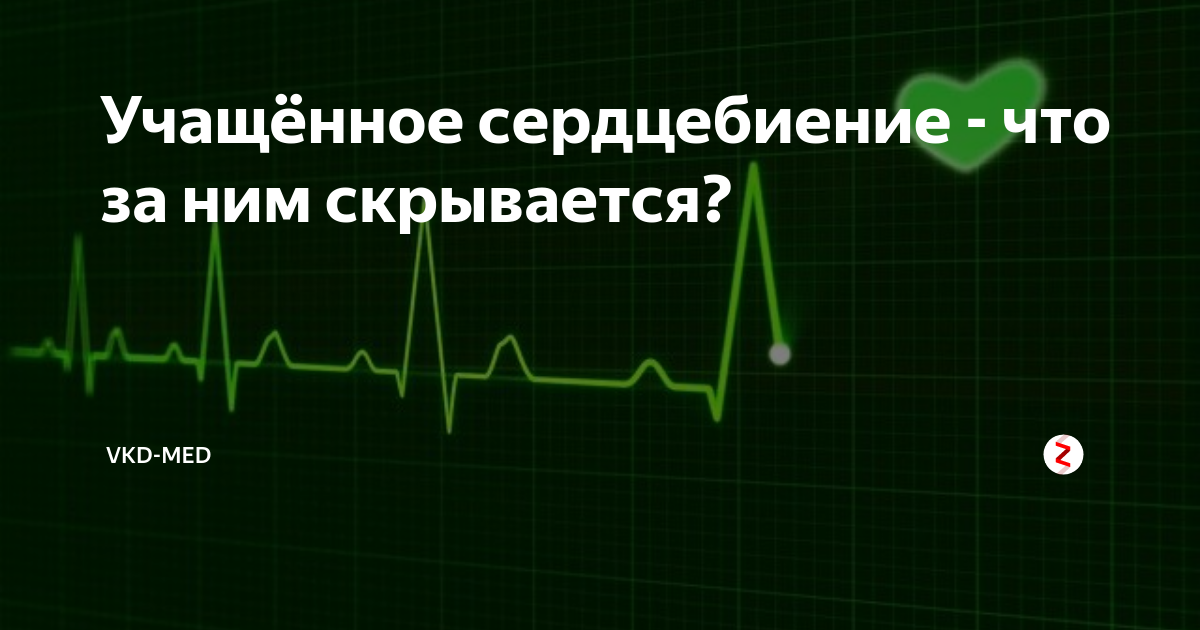 Учащенное сердцебиение. Учащённое сердцебиение. Причины учащения сердцебиения. Учащённое сердцебиение пульс. После еды сердцебиение учащается