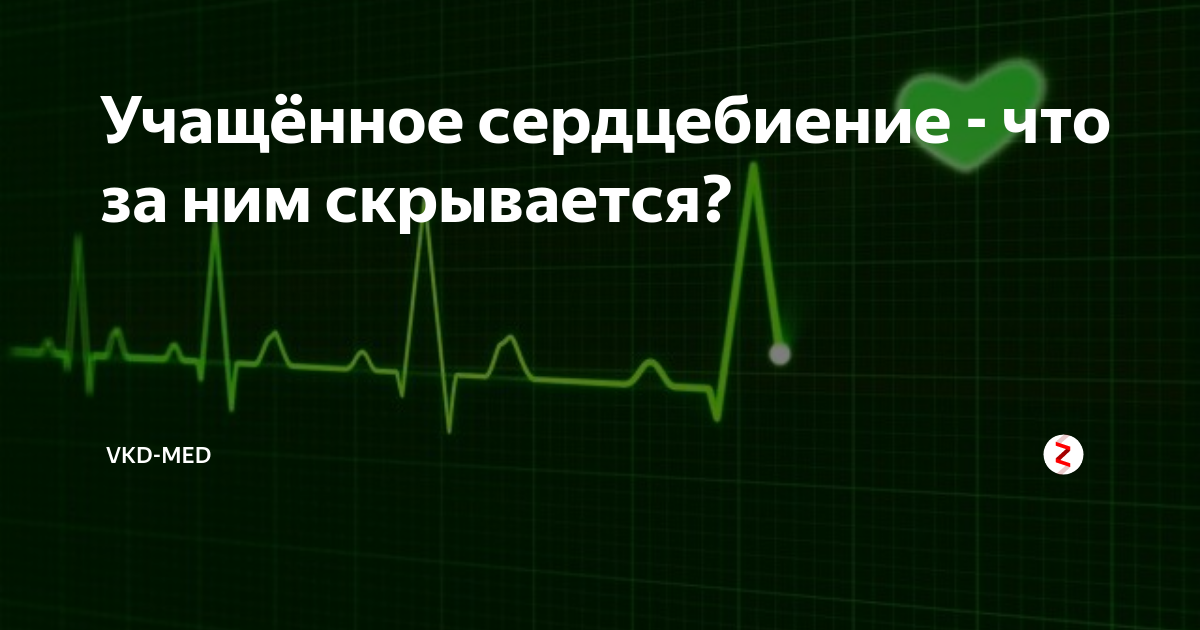 Сердцебиение это. Учащённое сердцебиение. Причины учащения сердцебиения. Учащённое сердцебиение пульс. После еды сердцебиение учащается.