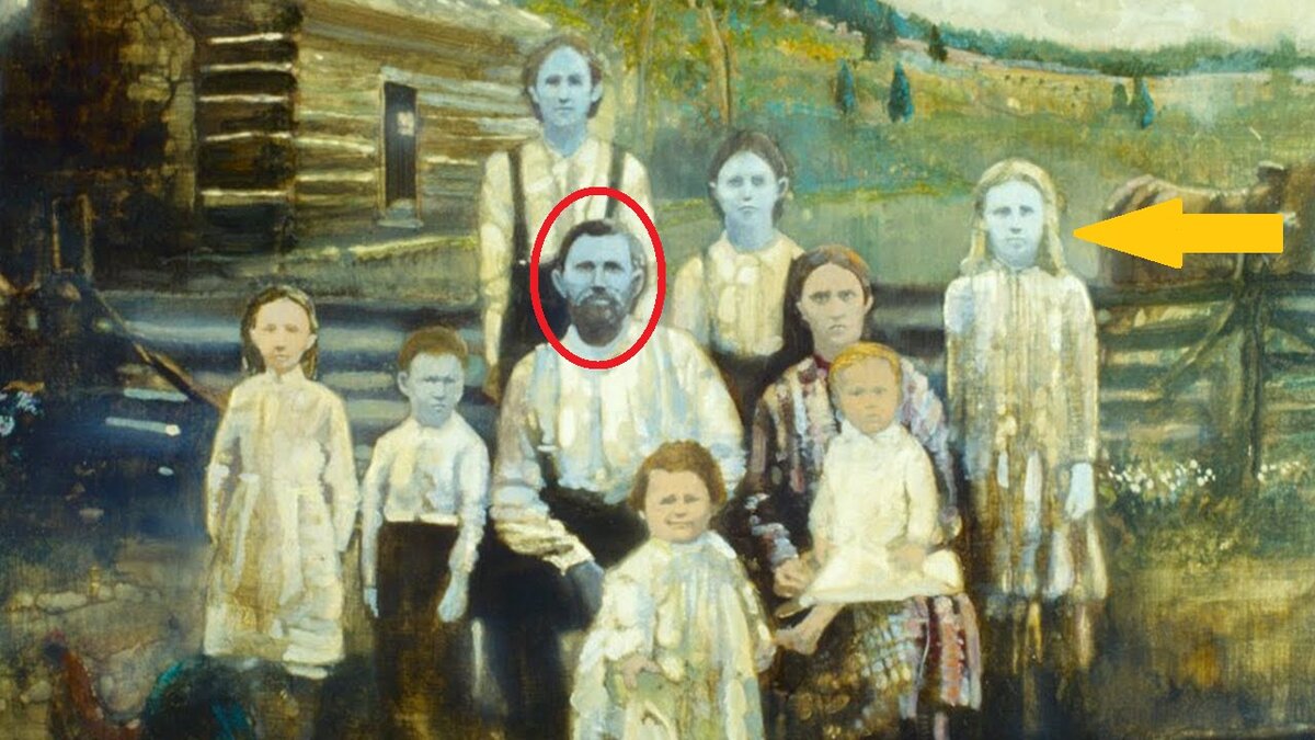 Заболевание, синяя кожа, мутация, гены.