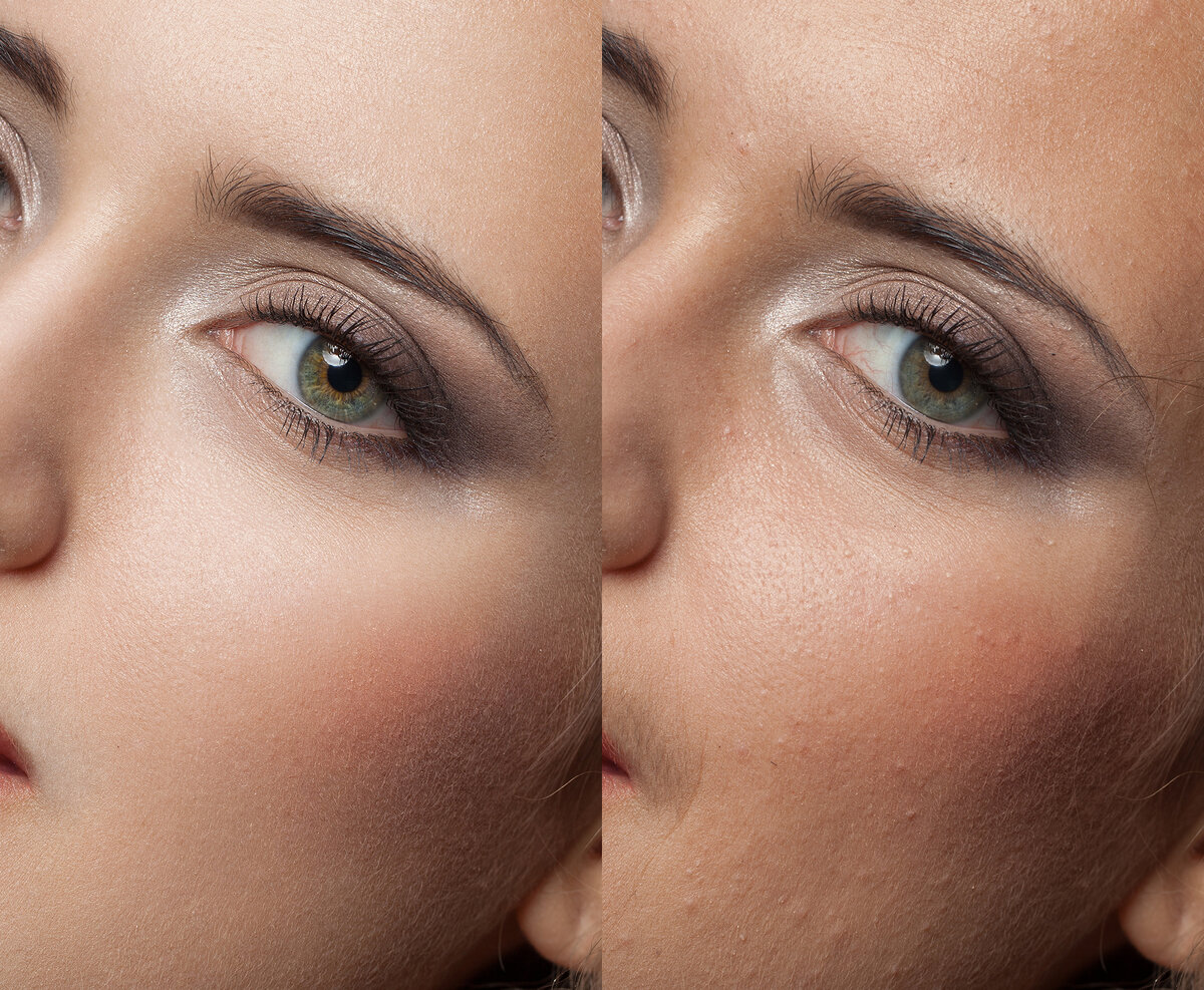 слева после ретуши, справа до.