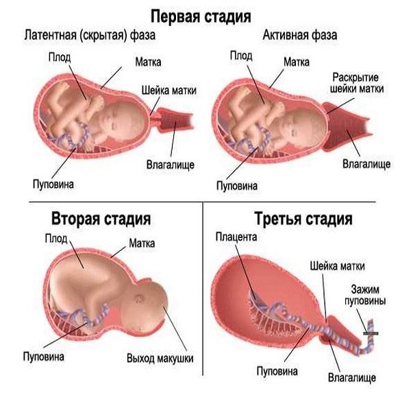 Схватки рассказы. Фазы родов. Как проходят роды у первородящих. Этап родового процесса.