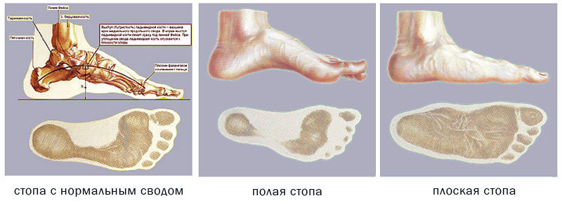 Нормальная стопа человека фото