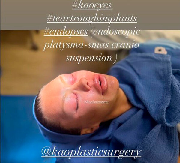    Фото: kaoplasticsurgery / Instagram