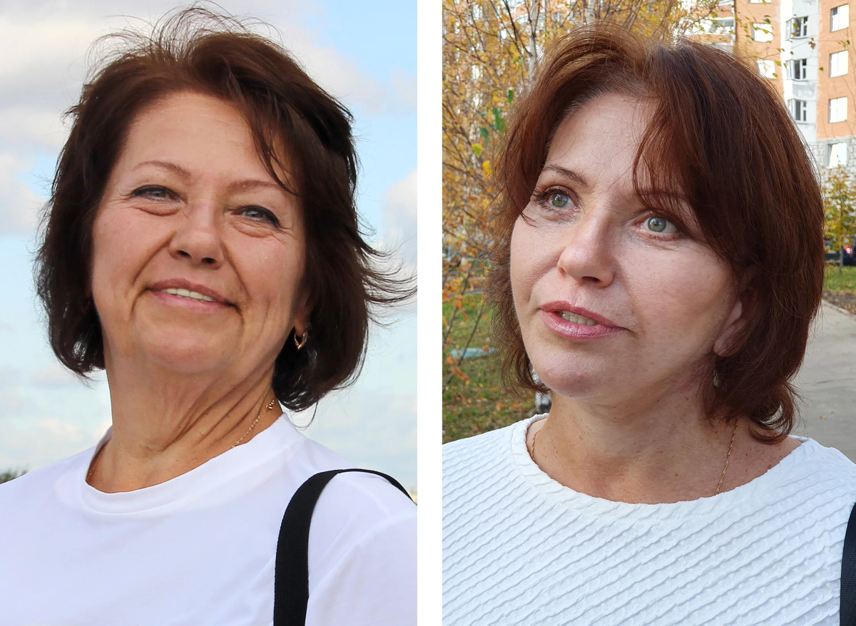 Результат круговой подтяжки лица после массивного похудения.