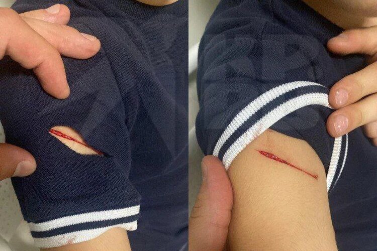 Мальчик получил достаточно глубокий порез. Фото: предоставлено мамой пострадавшего мальчика 
