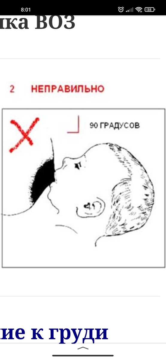 Это очень больно когда ребенок захватывает только сосок. На себе может почувствовать каждая кормящая женщина. 