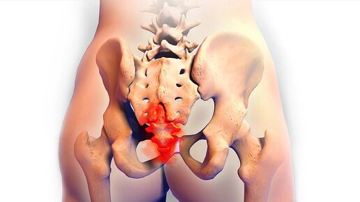 Крестец- священная кость и патология крестцово-подвздошного сочленения