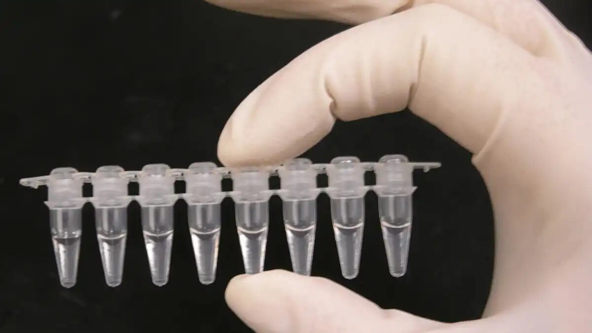 Фото:Madprime Эксперты оценили развитие мирового рынка тестирование на ГМО