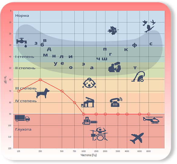 Полученная в результате замеров аудиограмма позволяет оценить степень потери слуха. Однако для комфортного использования слухового аппарата нужно понять, какое усиление необходимо для каждой частоты.