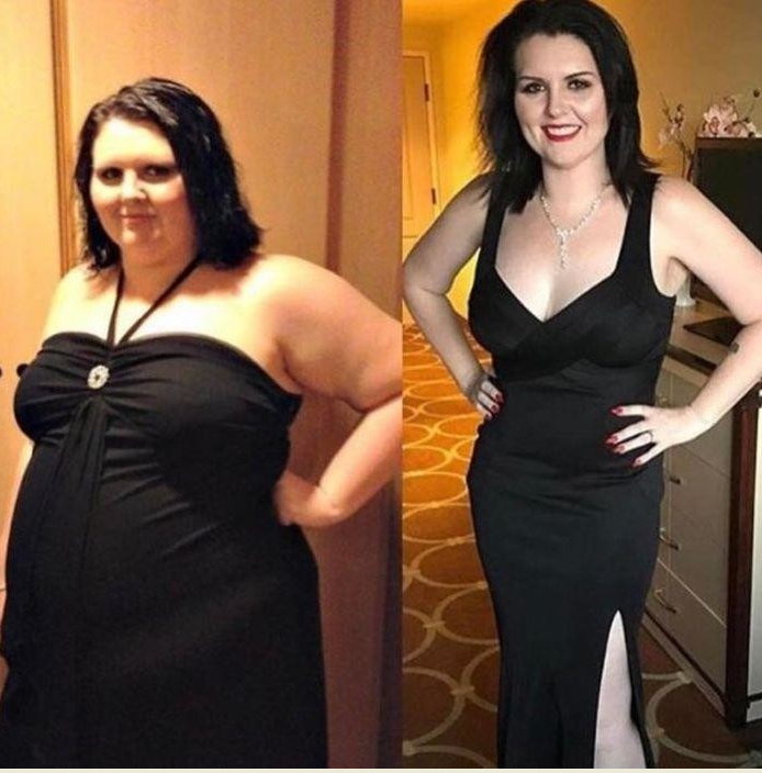 Похудение до и после. Девушка похудела. Похудение до после женщина. Девушка похудела. Похудела до и после.