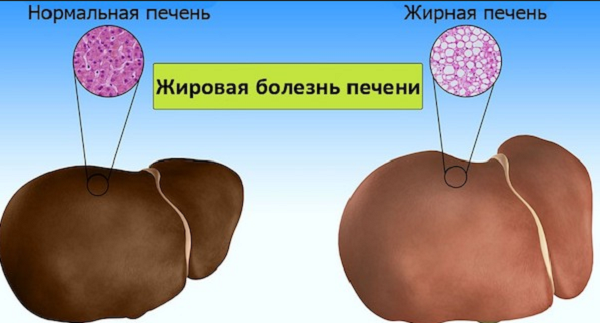 фото: http://health.hozvo.ru