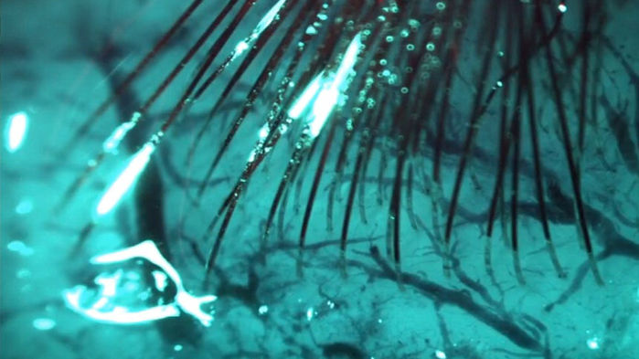 Neuralink разрабатывает систему ультратонких электродов, которые проникают в мозг для чтения или стимуляции нейронов.