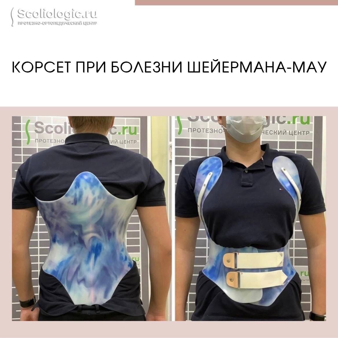 Корсет Шено