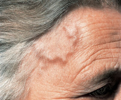 Фактор №1 – стресс