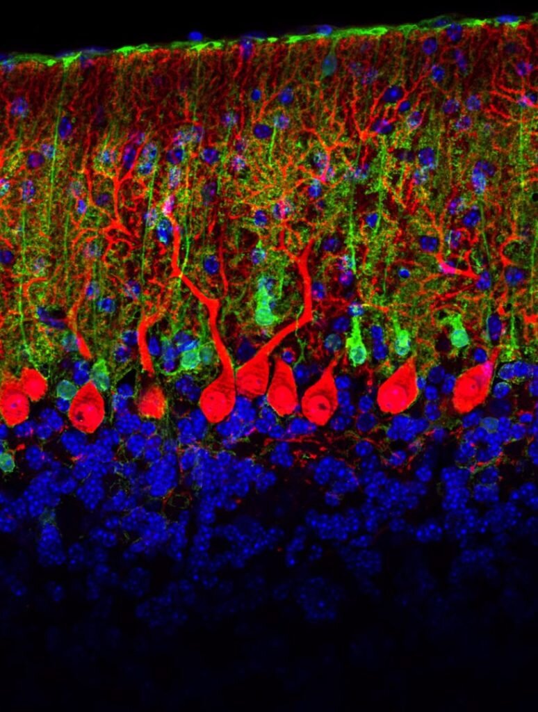  Credit: ROBIN SCHARRENBERG/Neuroart Давно мы не баловали вас красивыми картинками клеток Пуркинье — огромных клеток мозжечка, которым мы посвятили отдельную статью.