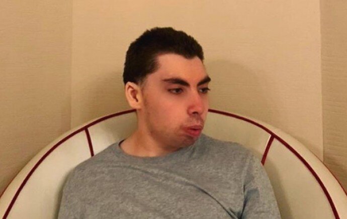 -2