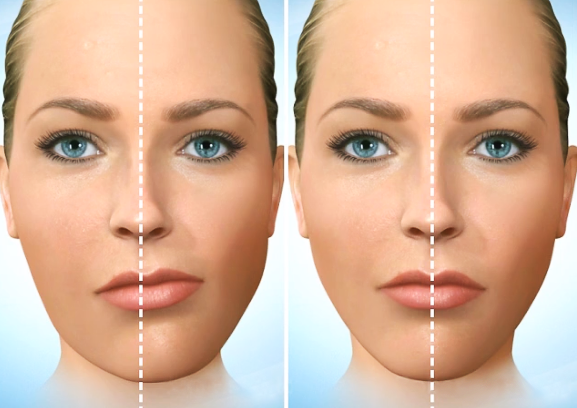 асимметричное лицо. из открытых источников интернета. 