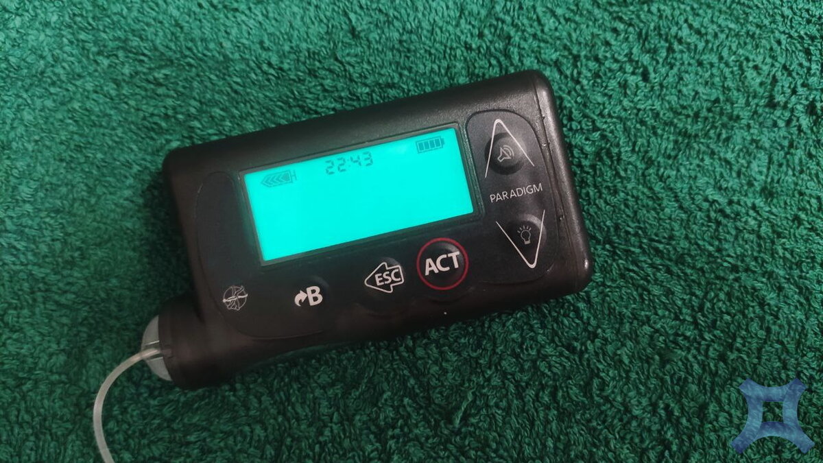 Помпа не ограничивает мою жизнь. С ней я также могу заниматься спортом, плавать (предварительно сняв её и поставив заглушку).