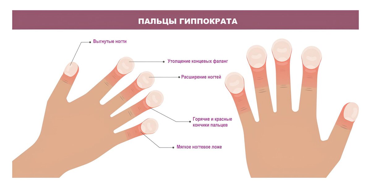 11. Почемучка спрашивает почему две дырочки в носу