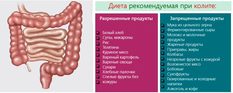 Синдром раздраженного кишечника долихосигма у взрослых. Питание при кишечном колите. Диета при кишечном колите.