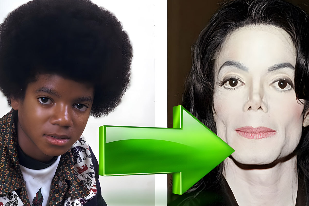 «Black or White»: почему кожа Майкла Джексона стала белой