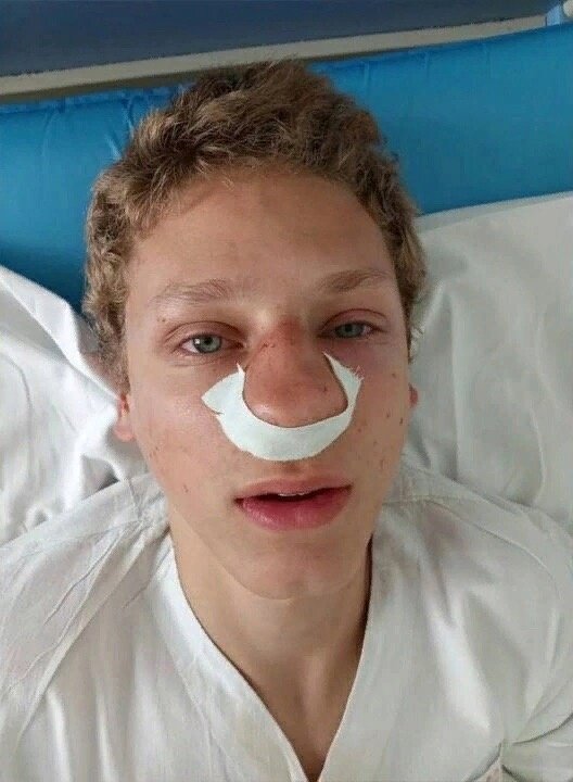 В Воронеже мужчина повредил нос подростка, который стоял на стороне своей  матери в конфликте на дороге | Новости шоу-бизнес | Дзен
