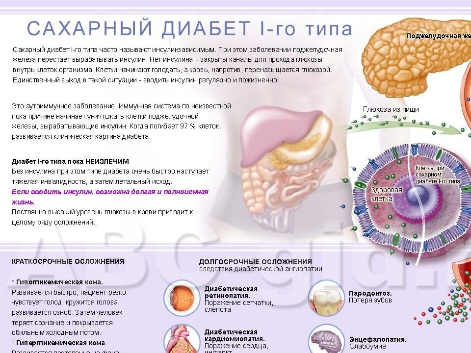 Нарушения липидного обмена при сахарном диабете: почему это важно знать и как с этим бороться