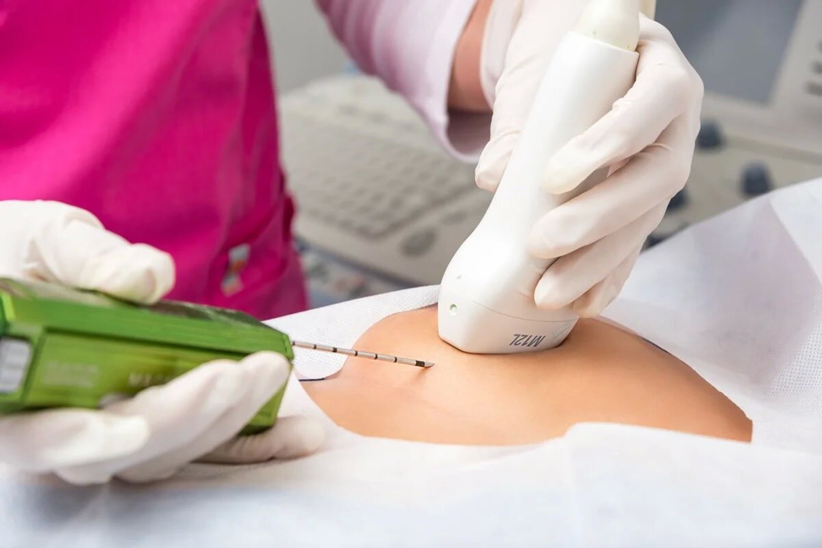 Биопсия образования груди. 