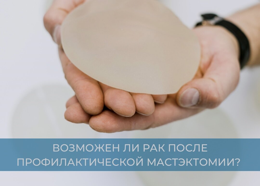 Рак после профилактической мастэктомии? | Владимир Соболевский ...