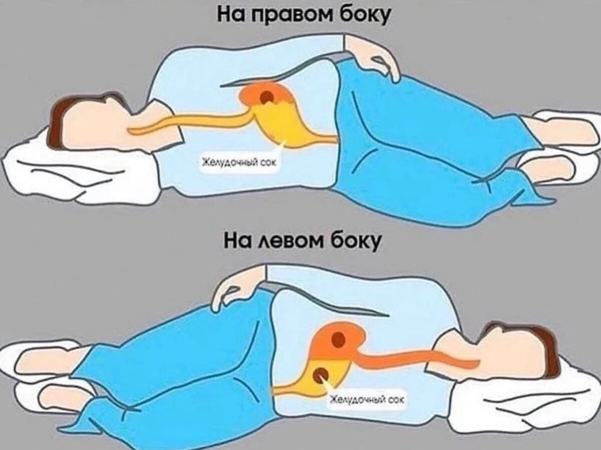 Спать на боку. На каком боку лучше спать. На каком блку лусше спа ь. Спать на левом боку. Правильная поза для сна.