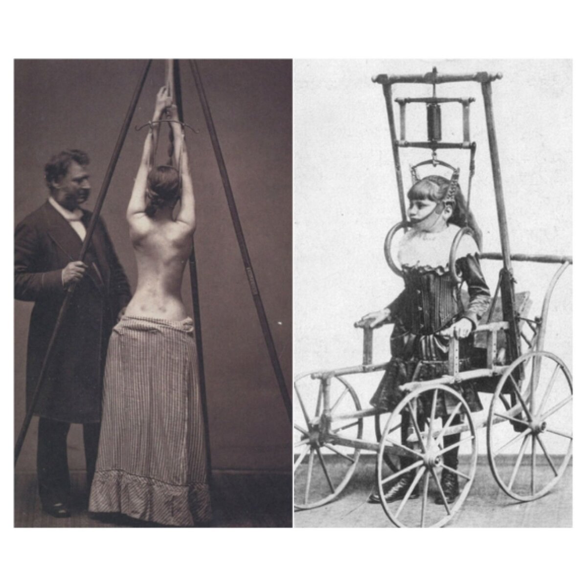 Изображения и описания людей с деформациями позвоночника своими корнями уходят в далекое прошлое. В V в. до н.э. Гиппократ впервые описал сколиоз. Он сконструировал аппарат, который вытягивал позвоночник и корректировал его дефекты. Во II в. н.э. Гален ввел такие новые слова как сколиоз, кифоз и лордоз, а также описал их лечение с помощью фиксирования грудной клетки и применения специального корсета для спины. В период Средневековья полагалось, что такая болезнь была карой небесной и поэтому такие пациенты рассматривались как еретики. Позже, в середине XVI в. во Франции, Амбруаз Паре впервые описал врожденный сколиоз. Он понял, что причиной паралича является сдавление спинного мозга. Он также описал лечение последствий открытого перелома на основе своего открытого большеберцового перелома, который сросся без каких-либо осложнений. В течение последующих 30 лет Паре продолжал развивать проблему деформаций позвоночника, а также представил новый ортопедический корсет, который изготовлялся приблизительно каждые 3 месяца.
Предполагается, что в 1741 Николас Андре впервые создал слово Ортопедия.
Андре считал, что сколиоз это результат мышечной недостаточности и слабой осанки. Соответственно, он полагал, что правильные столы и стулья очень важны для предотвращения сколиоза.
Оба брата ЛеВахер внесли свой вклад в развитие лечения деформаций позвоночника. Франсуа-Гийом изобрел гипсовый воротник и гипсовый корсет для лечения туберкулеза позвоночника,а
Томас написал книгу о сколиозе и изобрел стул для растяжки с вертикальным вытяжением.
Жан Андре Венел в 1780 г. купил старое аббатство и основал первую ортопедическую больницу, которая специализировалась на лечении скелетных дефектов. Он разработал дневной корсет для сколиоза. На ночь этот корсет снимался, а пациент ложился на ортопедическую кровать для растяжки.
Именно после этого идея ортопедической кровати стала очень популярной. Венел достиг многого в лечении скелетных дефектов и по праву претендует на звание «Отец ортопедии».