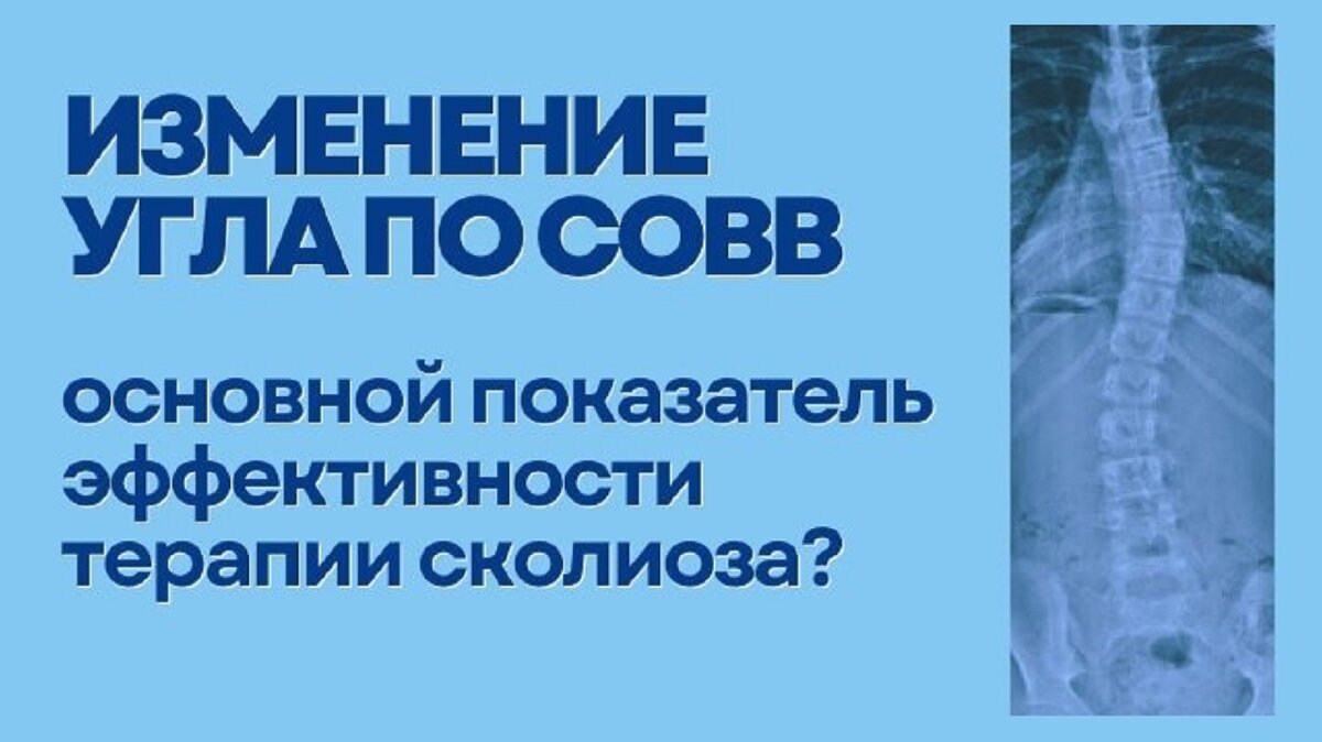 Изменение угла по Cobb основной показатель эффективности терапии сколиоза?
