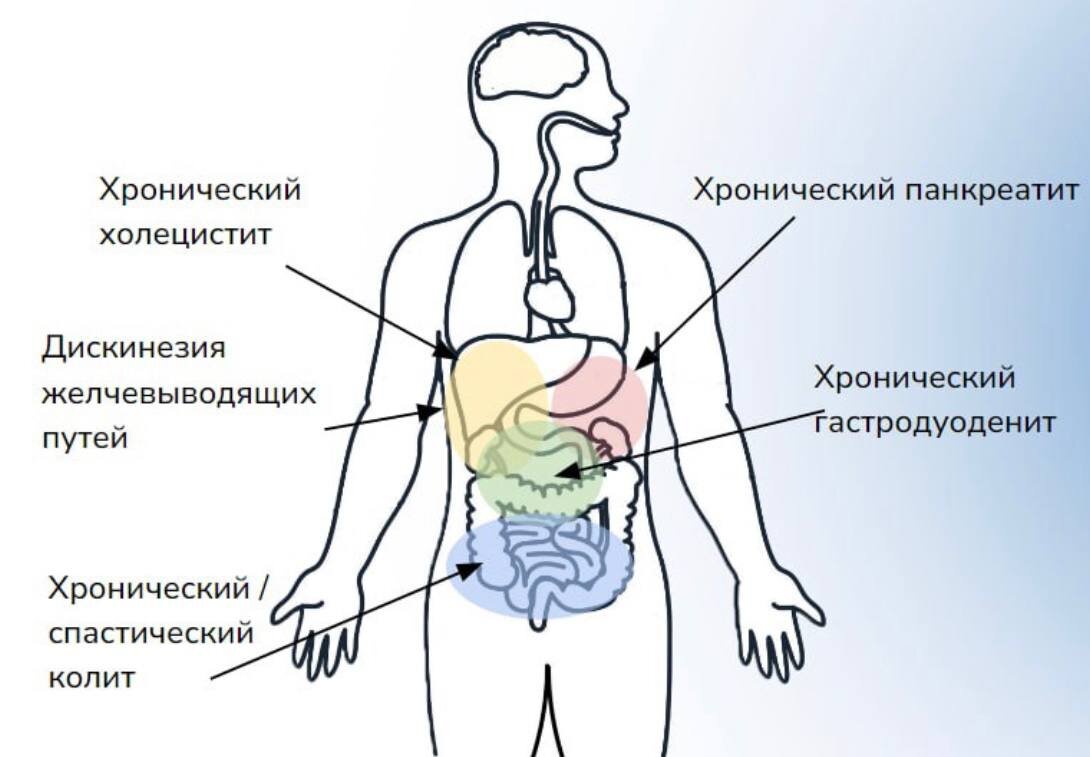 Что скрывается под гастродуоденитом, холециститом, колитом и проч. |  Гастроэнтеролог Лопатина М.В | Дзен