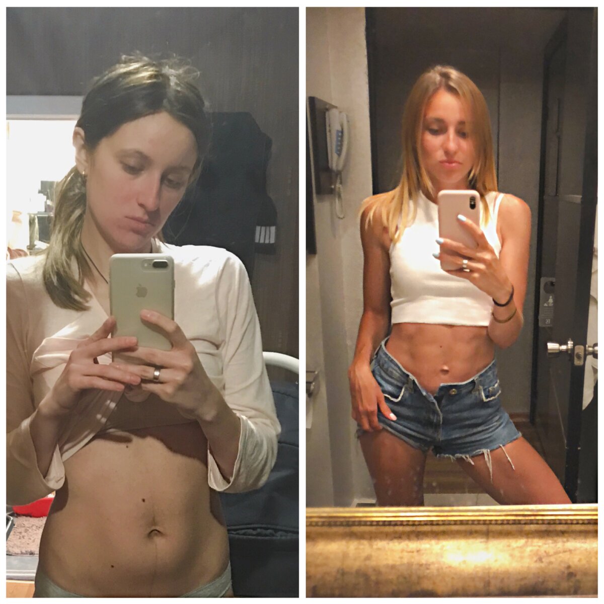 слева—2 месяца после родов, справа— спустя 1,5 года