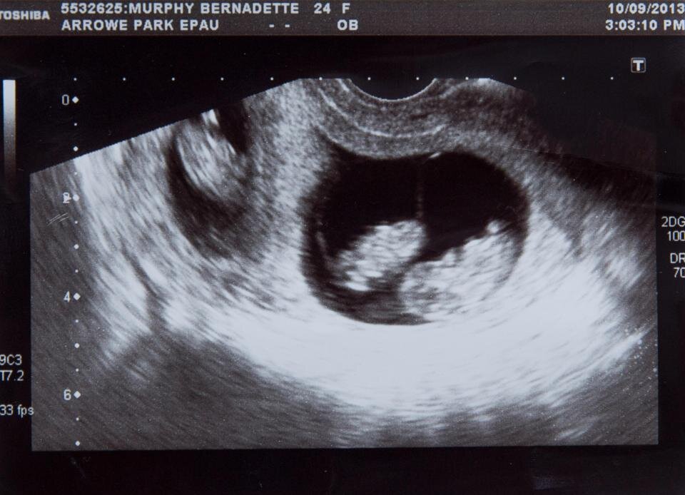 Фото The Irish Sun